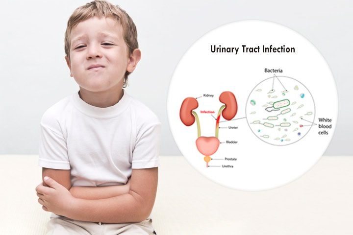 uti