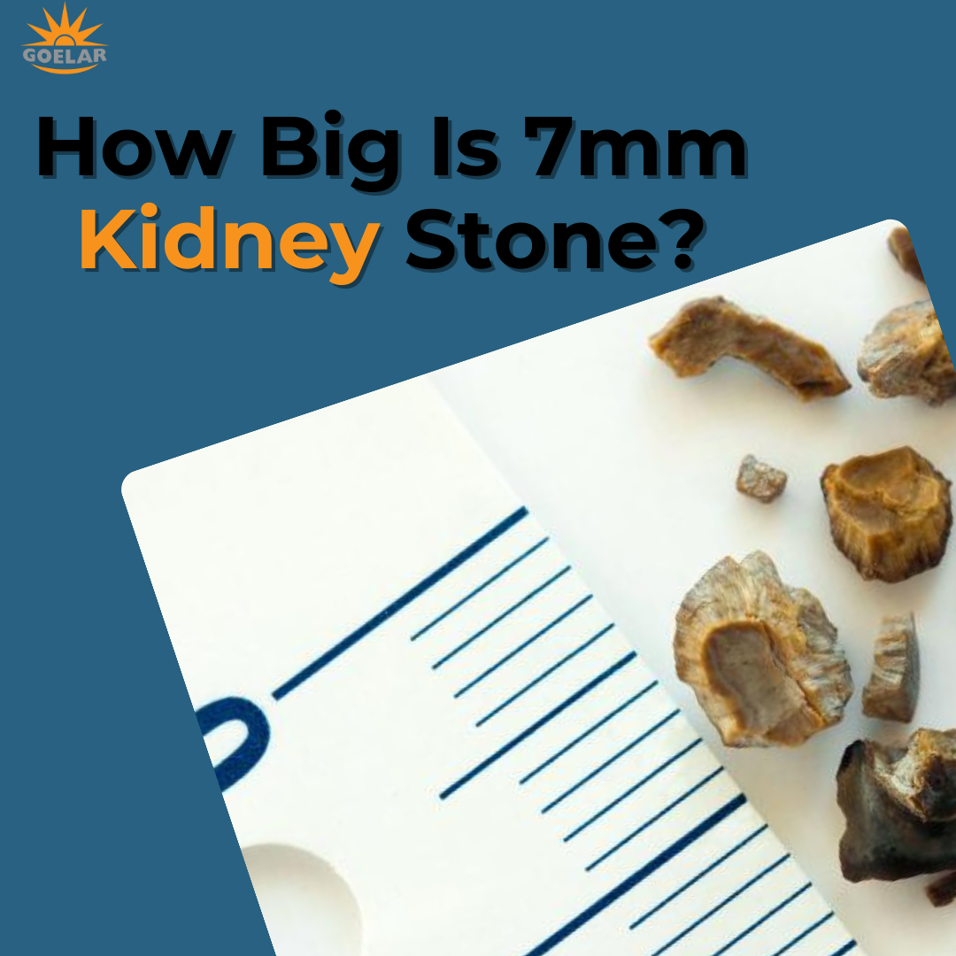 how-big-is-7mm-kidney-stone-kidney-stone-size-chart-goelar-health-group