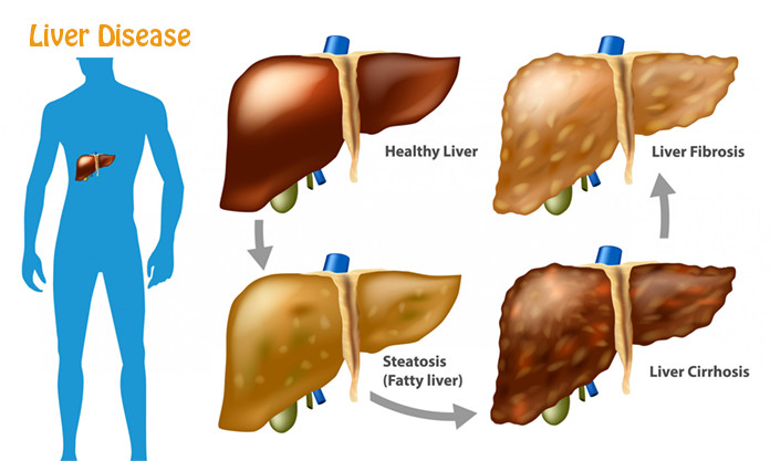 Liver