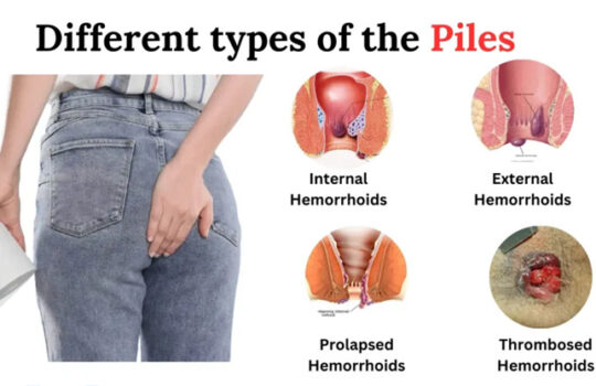piles