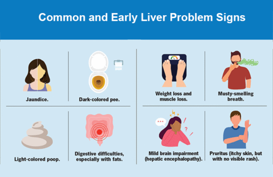 Liver Problem Signs