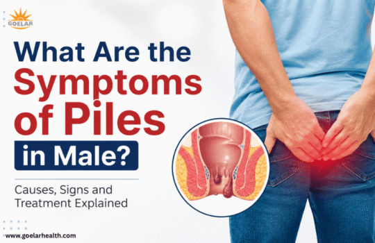 What Are the Symptoms-of-Piles-in-Male