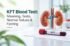 kft-blood-test-meaning-tests-normal-values-and-fasting