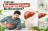 Can an Enlarged Liver Be Reversed?